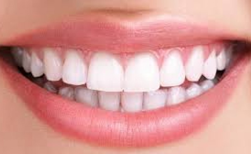 چگونه دندان‌های خود را سفید کنیم؟